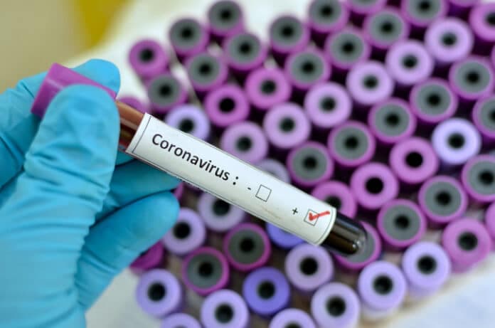 Ghana hits 566 cases of Covid 19